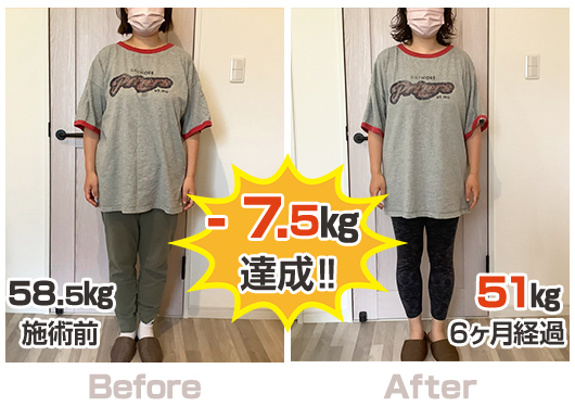 BA②