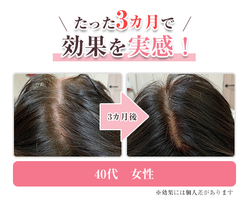 BA②